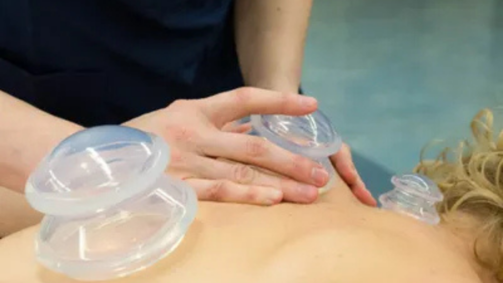 Body Dynamic Cupping in Edmonton at Viva Massage